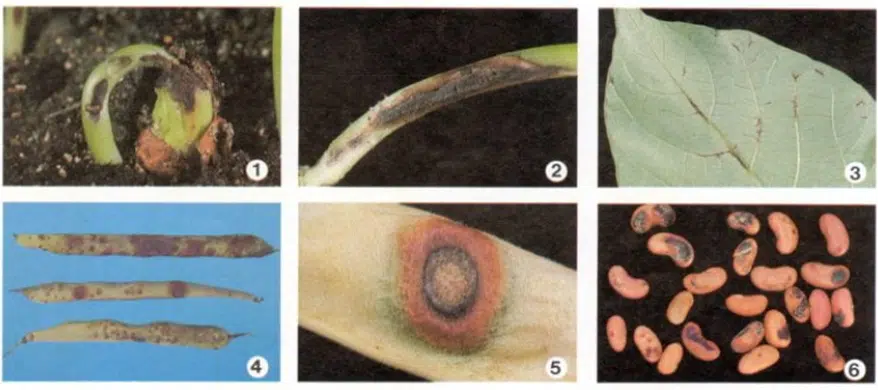 Sintomas de antracnose no feijão